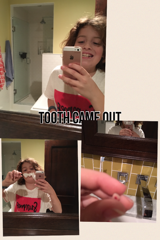 Tooth came out