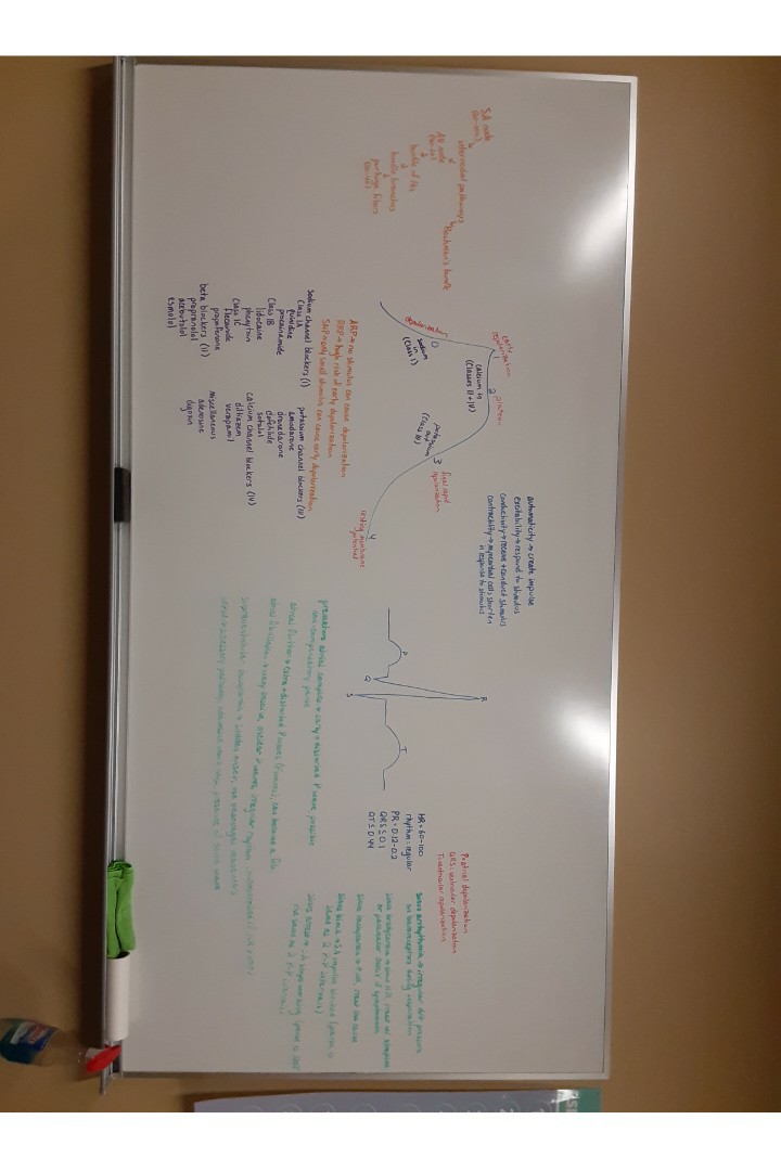 picture is sideways but I filled this whole whiteboard studying for my exam on ECGs

I've been struggling lately because I've been super busy (like constantly running from one thing to the next every day) but my mental health has been kinda terrible the l