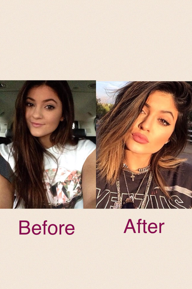 Kylie!! Why did you change yourself?? You were BEAUTIFUL!!