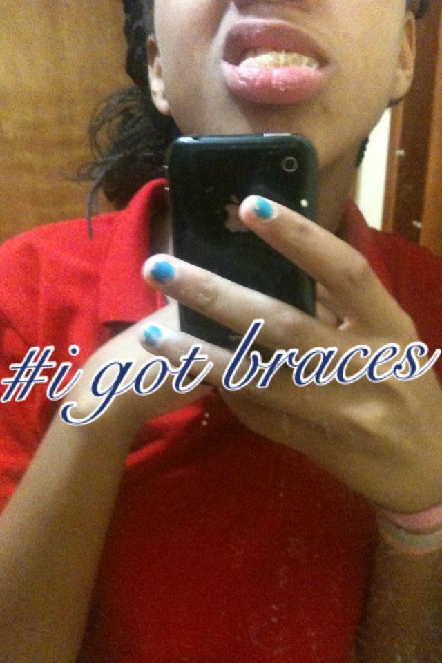 #i got braces