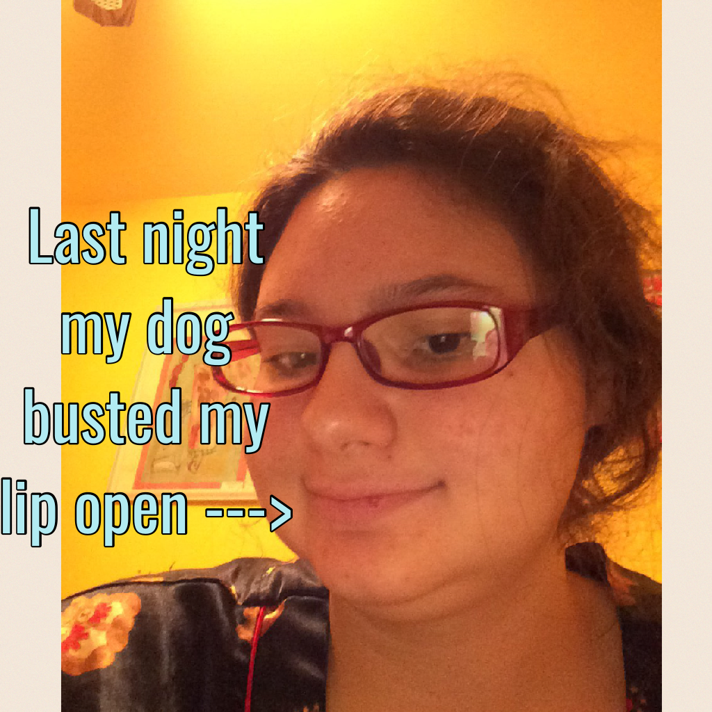 Last night my dog busted my lip open --->
