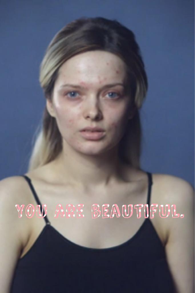 You are beautiful. 
Stop cyberbullying and bullying. You are beautiful.