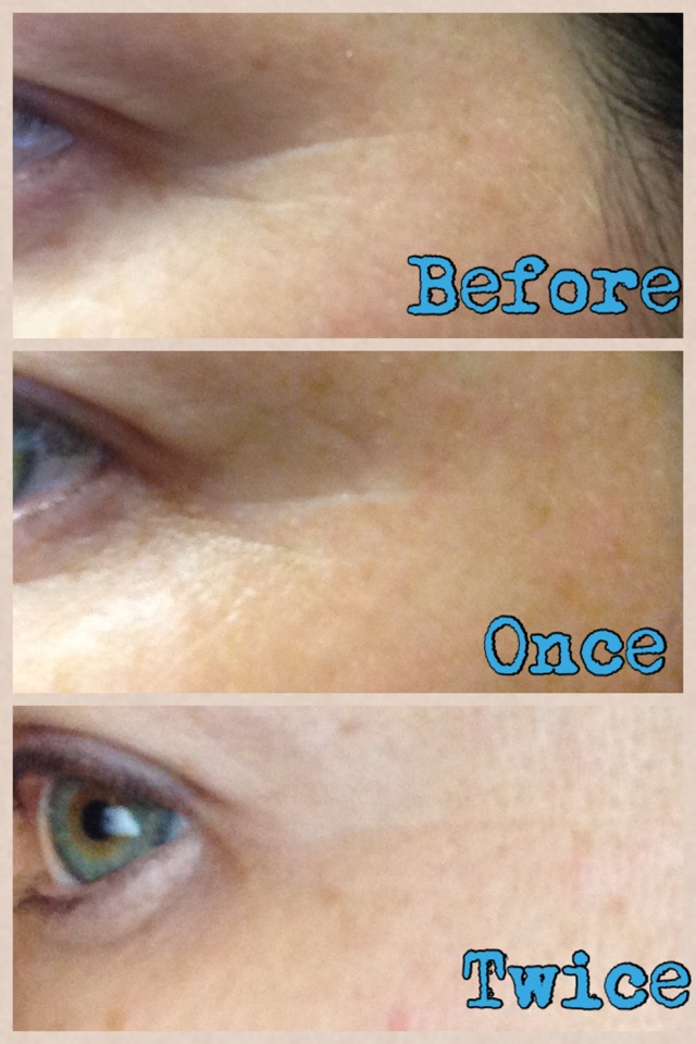 Results after using Acute Care twice!! Wow, I love it. #wrinklewarrior 