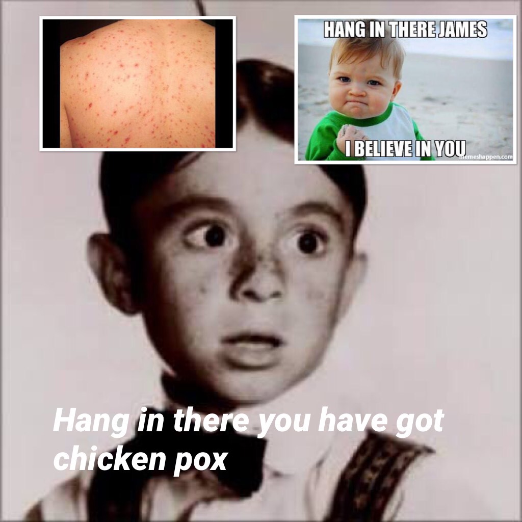 Hang in there you have got chicken pox