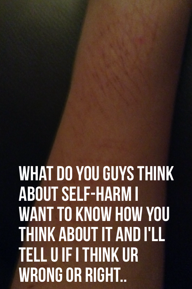 What do you guys think about self-harm? I have had bad experiences in my life one stage I'll never be able to forget however much I want to forget about them.