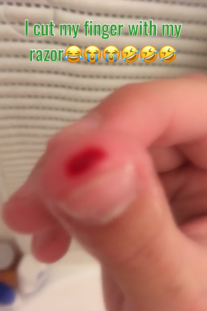 ACCIDENTALLY!! (Tappp)
I didn't even notice until I saw the red on the blade😅