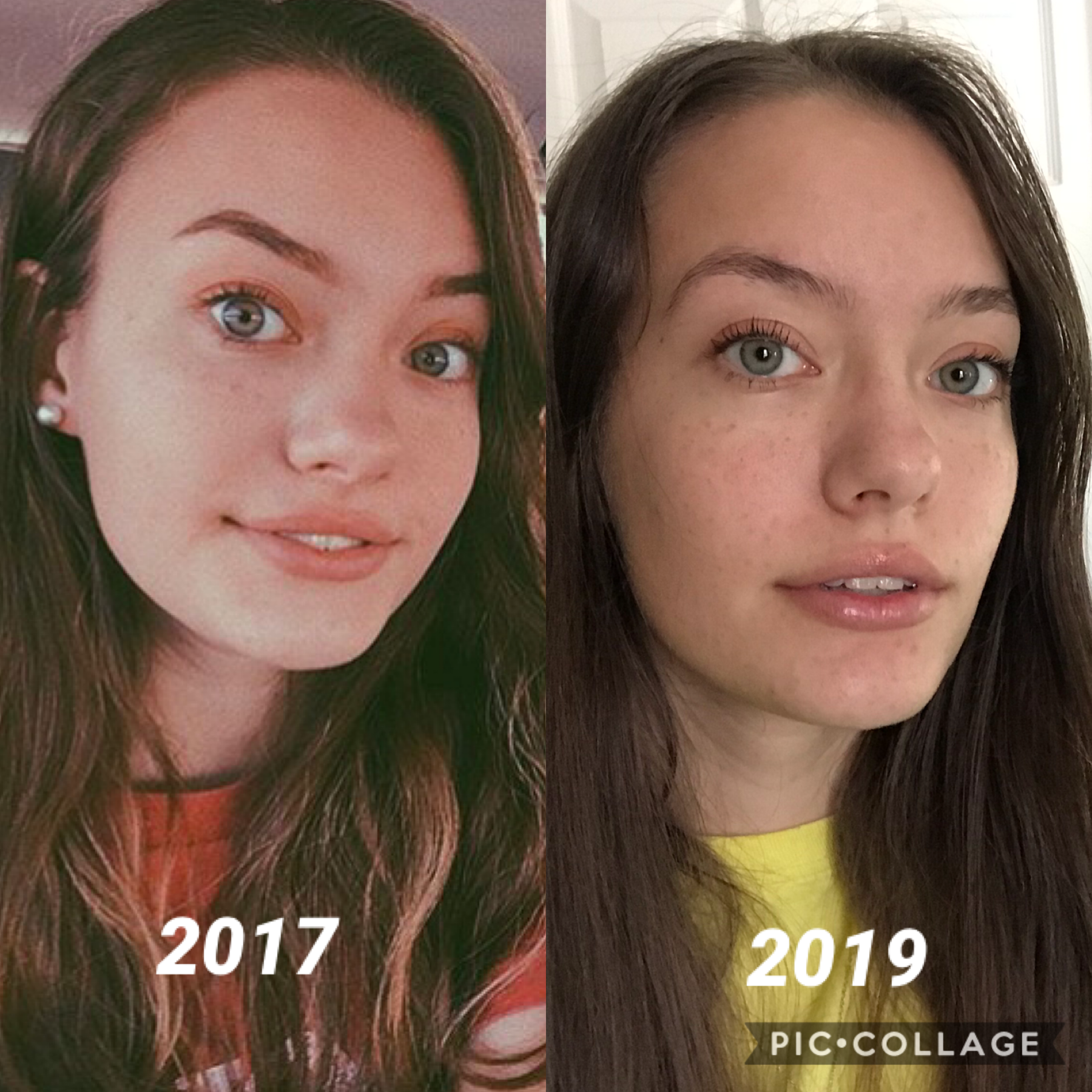 tw?
has she glowed up 🤭 (minus the fact that i don’t fill in my eyebrows anymore lol) also i can’t tell if my now pic is bc i’ve lost weight or gained bone structure 😂 rn i weigh the lightest i’ve been since freshman year oof. the first pic is from sophom