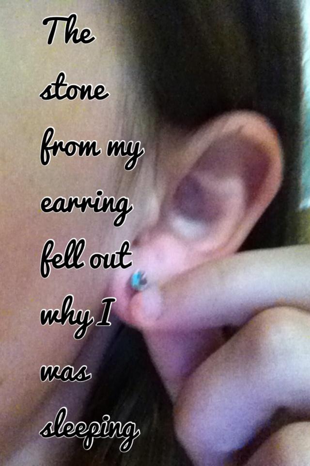 The stone from my earring fell out why I was sleeping