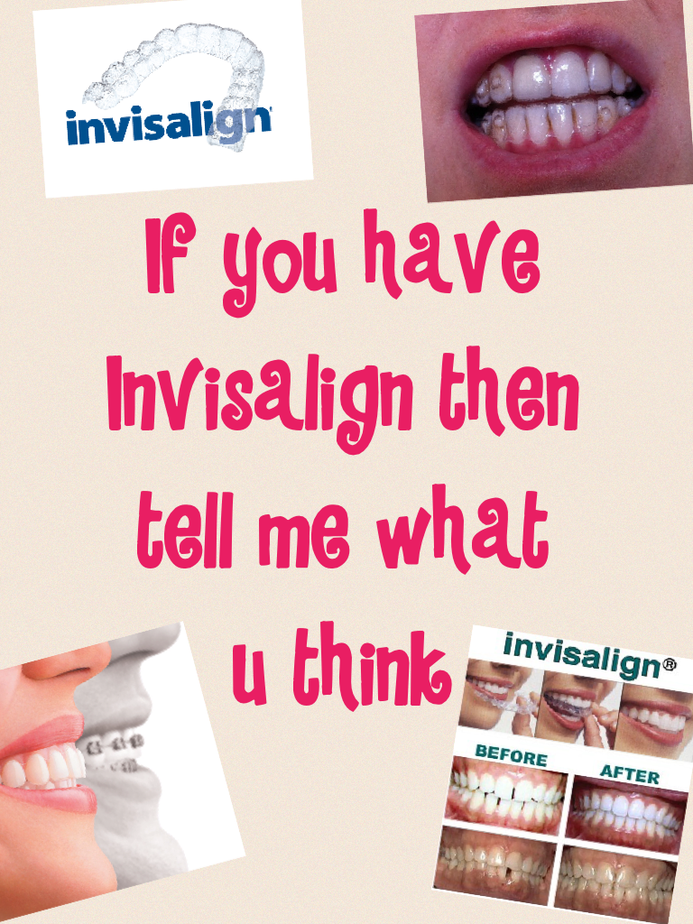 If you have 
Invisalign then 
tell me what 
u think 