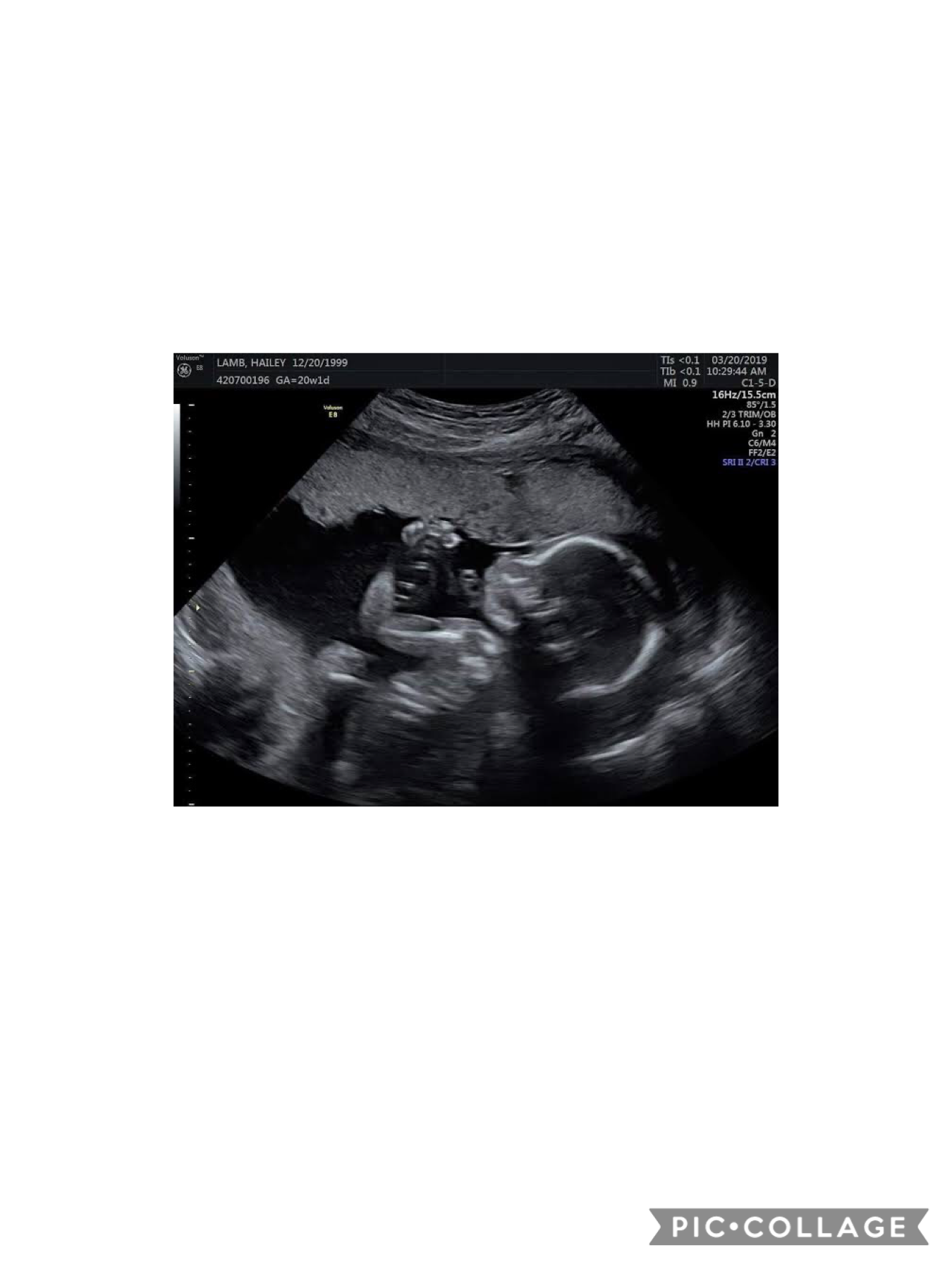 Baby p I’m so excited to meet you I will try to be the best dad ever 
