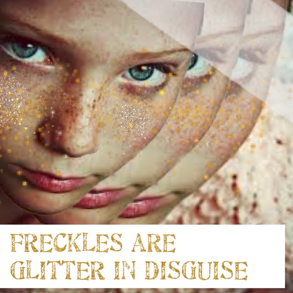 Freckles are glitter in disguise
