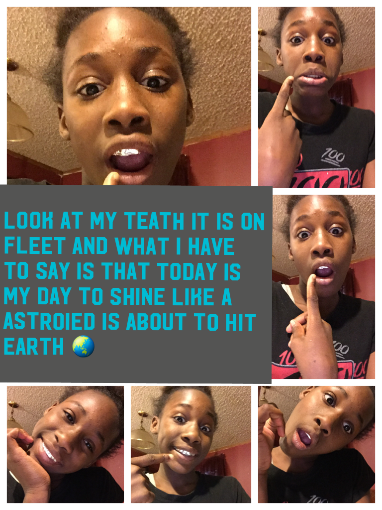 Look at my TEATH it is on fleet and what I have to say is that today is my day to shine like a astroied is about to hit earth 🌏 